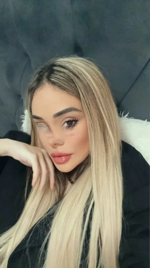 Lupita