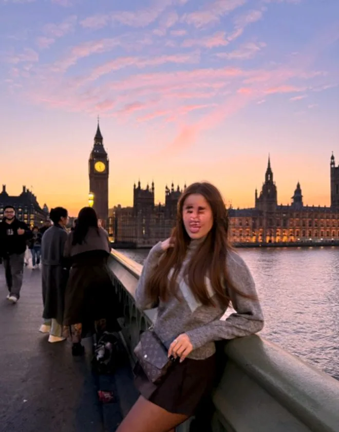 Chloe Amelie